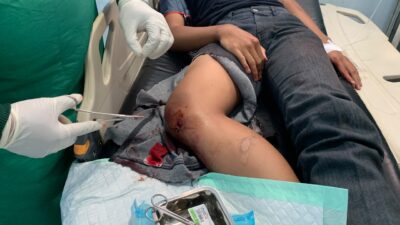 KECELAKAAN DI JALAN JENDERAL SUDIRMAN BELITUNG, PELAJAR 14 TAHUN ALAMI PATAH TULANG
